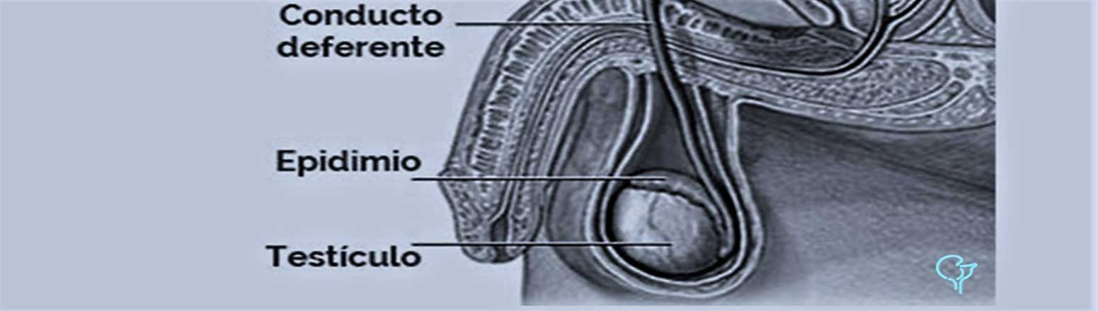 Hidrocele y Varicocele